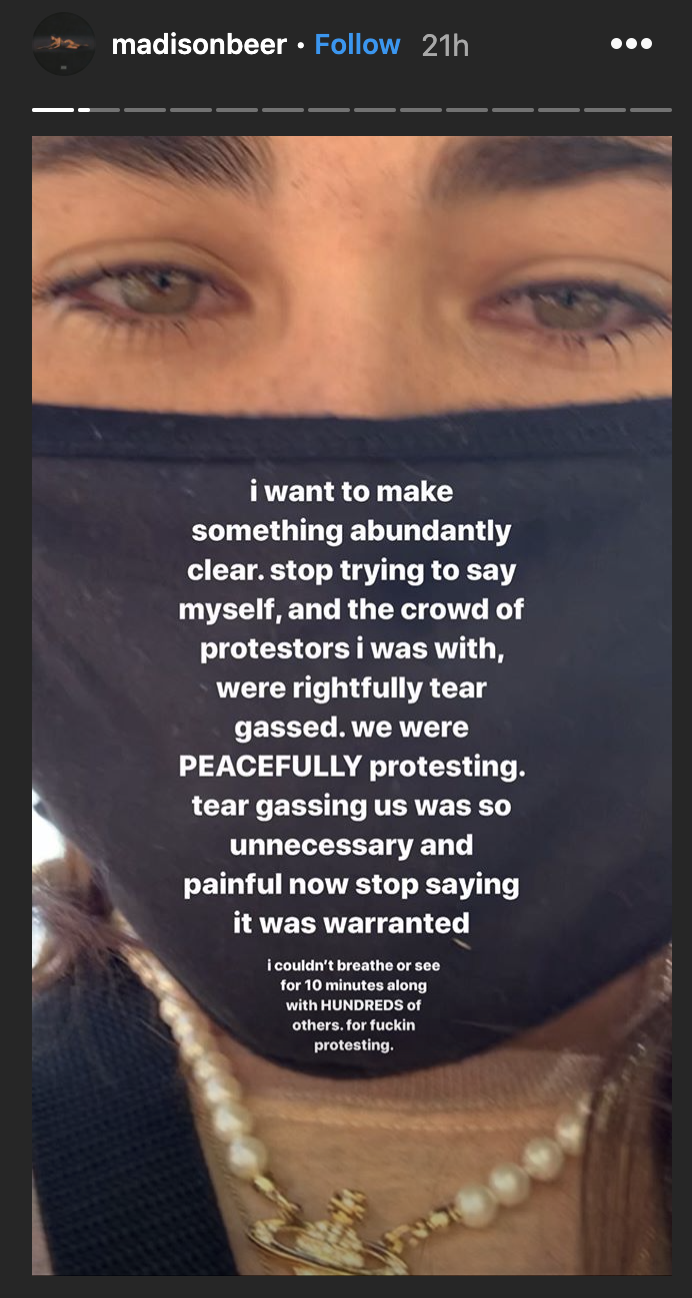 Madison Beer said police hit her with tear gas. (Photo: Instagram)