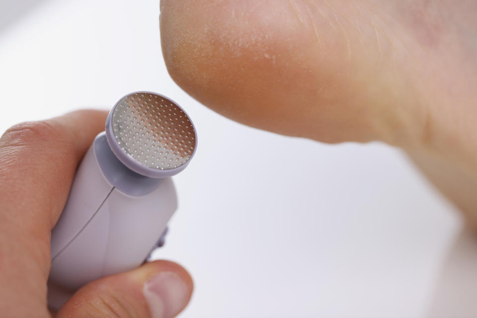 Callus peeling using professional pedicure drill machine. spa foot treatment. Removing hard calloused skin for soft feet.