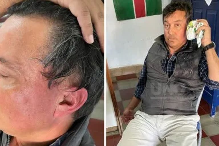 Feroz golpiza de un presidente comunal del norte santafesino a un productor ganadero