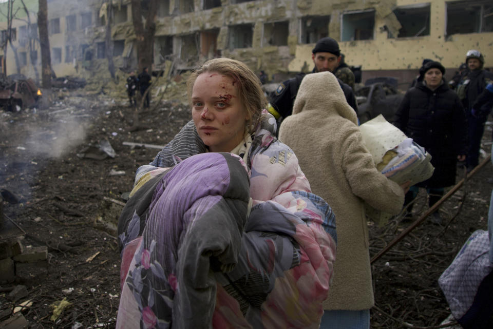 FILE - Marianna Vishegirskaya stands outside a maternity hospital that was damaged by shelling in Mariupol, Ukraine, Wednesday, March 9, 2022. (AP Photo/Mstyslav Chernov, File)