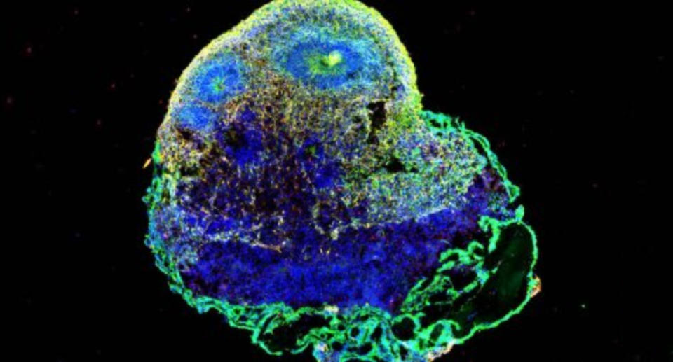 'Zombie' cells were accelerated in a synthetic brain model which glows green, blue and yellow under a microscope.