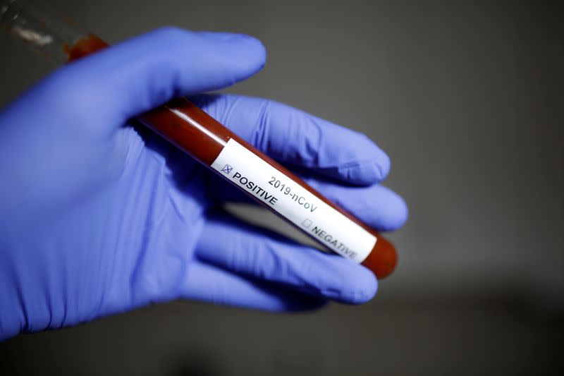 FILE PHOTO: Test tube with Corona virus name label is seen in this illustration picture