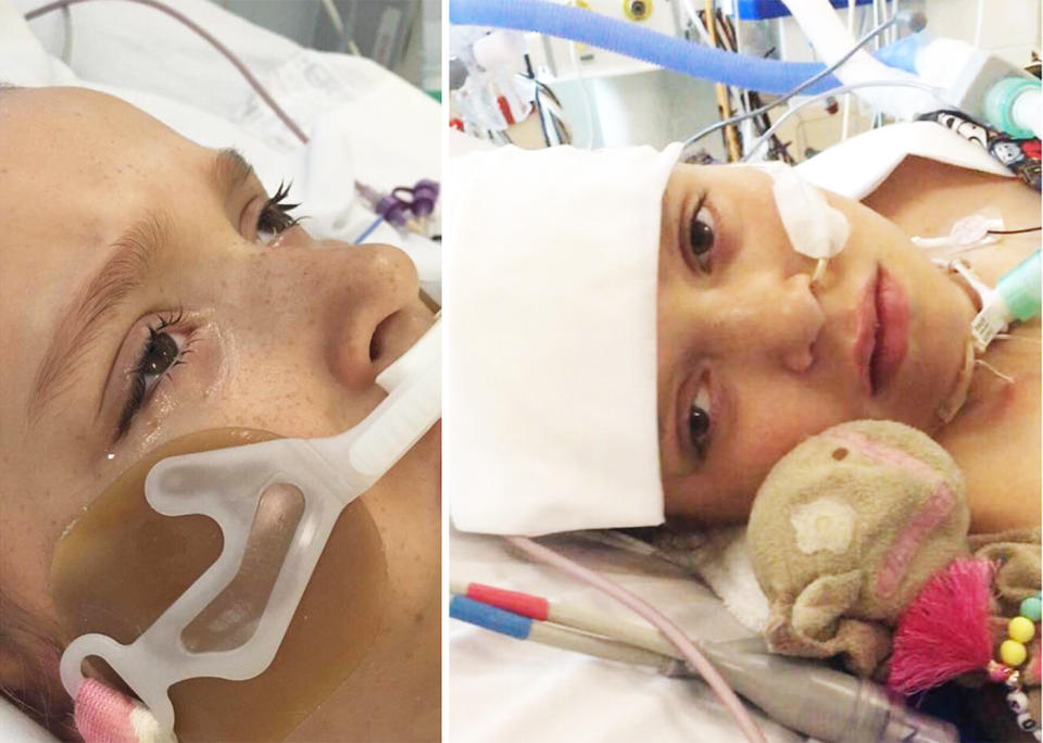 Abbie Sweeper opens her eyes at the Queensland Children's Hospital in Brisbane, where she has been in and out of an induced coma for two weeks. Source: Facebook