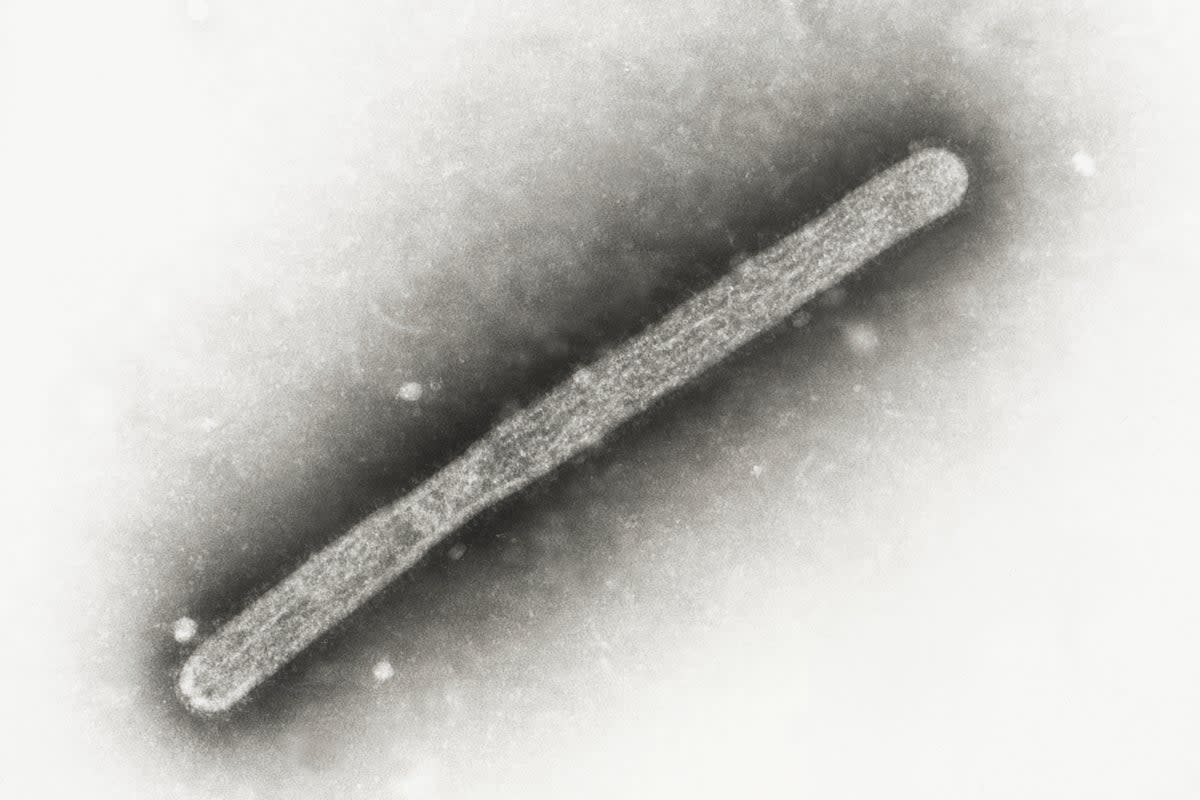 A 2005 electron microscope image shows the avian influenza strain H5N1. Bird flu is widespread in wild birds, and is causing outbreaks in poultry and dairy cows, and people who work around them. However, the CDC says that current public health risk is low. ((Cynthia Goldsmith, Jackie Katz/CDC via AP, File))