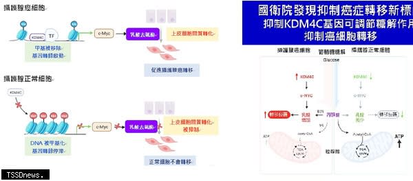 國衛院發現抑制癌症轉移新標的，抑制KDM4C可調節糖解作用抑制癌細胞轉移。