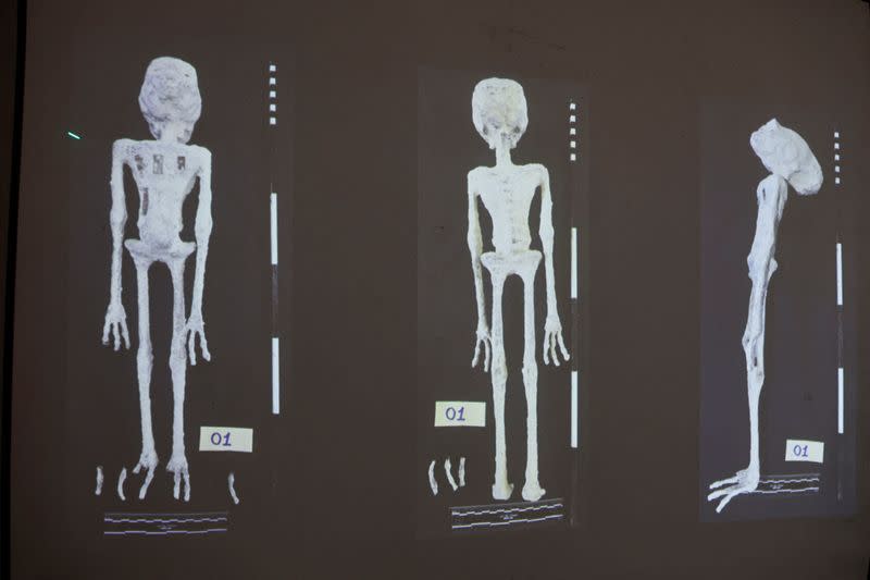 An X-rays and study carried out by the Institute of Legal Medicine of Peru on the 'alien mummies' that concluded that they are dolls made with animal bones is displayed in Lima