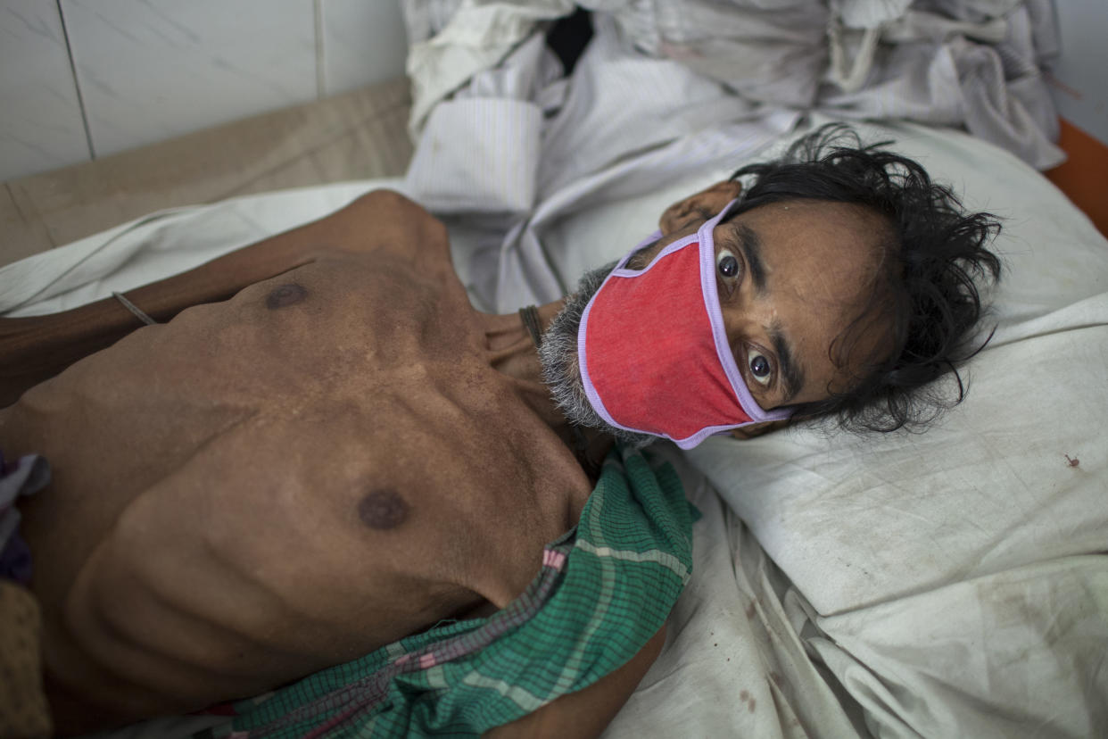 A 55-year-old tuberculosis patient in Bangladesh in 2016. It is&nbsp;estimated that 75 million people will die of multidrug-resistant TB by 2050.&nbsp; (Photo: Probal Rashid / LightRocket via Getty Images)