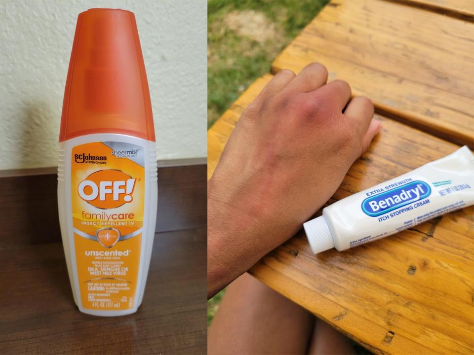 On the left: A bottle of OFF! bug repellent spray. On the right: A tube of Benadryl itch-stopping cream next to a hand with mosquito bites.