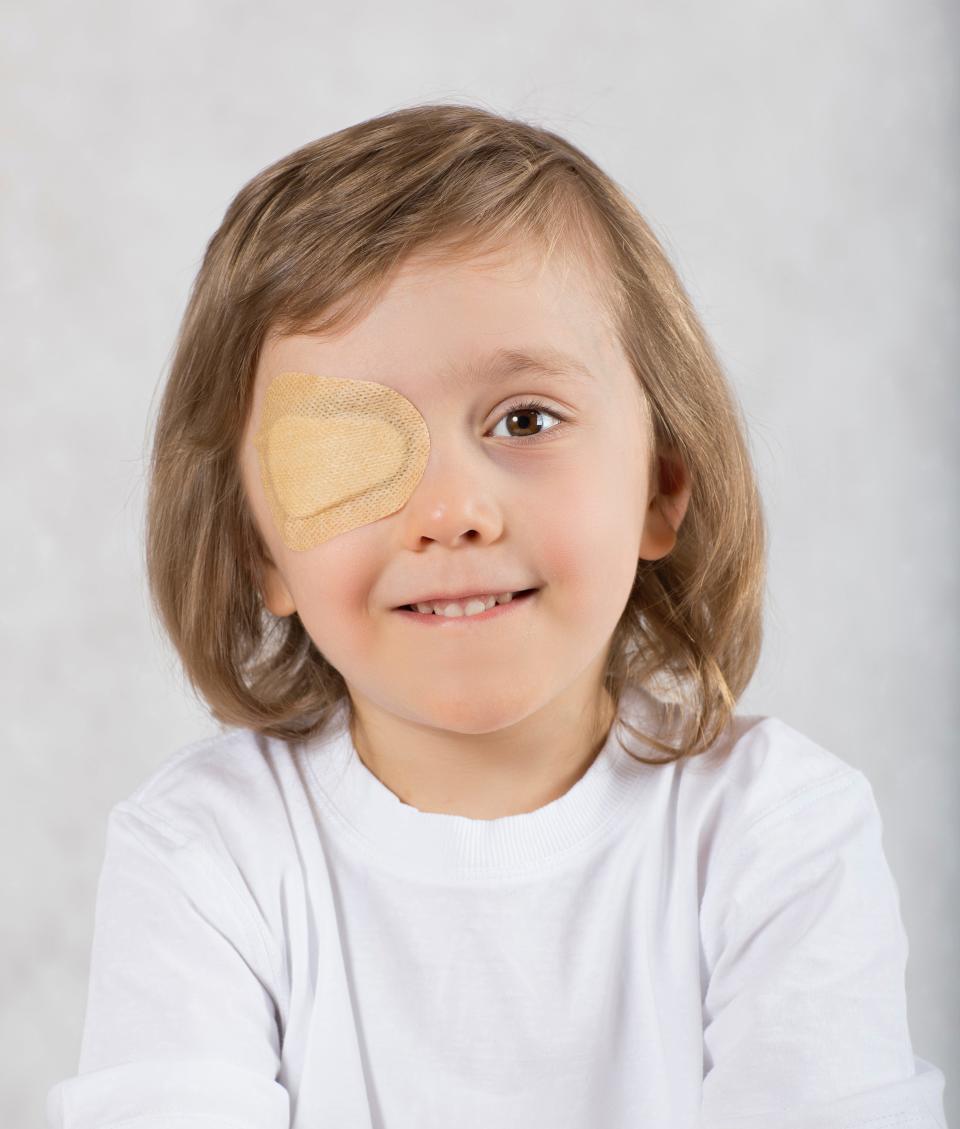 Amblyopia develops early in childhood and it rarely affects both eyes. Introducing an eye patch to cover the stronger eye is the most common treatment for a lazy eye. Having to use the weaker eye gives it a chance at strengthening and communicating more with the brain.