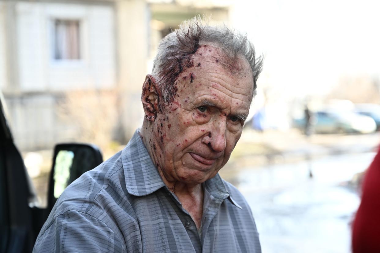 An injured man stands by a vehicle of an Emmergency unit to receive medical assistance after bombings on the eastern Ukraine town of Chuguiv on February 24, 2022, as Russian armed forces are trying to invade Ukraine from several directions, using rocket systems and helicopters to attack Ukrainian position in the south, the border guard service said. - Russia's ground forces on Thursday crossed into Ukraine from several directions, Ukraine's border guard service said, hours after President Vladimir Putin announced the launch of a major offensive. Russian tanks and other heavy equipment crossed the frontier in several northern regions, as well as from the Kremlin-annexed peninsula of Crimea in the south, the agency said. (Photo by Aris Messinis / AFP) (Photo by ARIS MESSINIS/AFP via Getty Images)