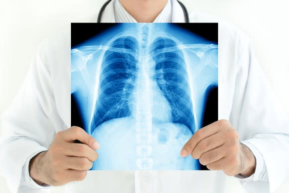 Doctor holding x-ray in front of his chest.