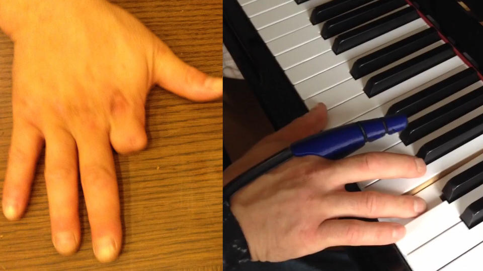 Mat Bowtell's friend, Yusuke, is pictured at the piano trying a new kinetic finger .