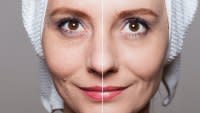 Before-After-Wrinkles-Stock-Photo