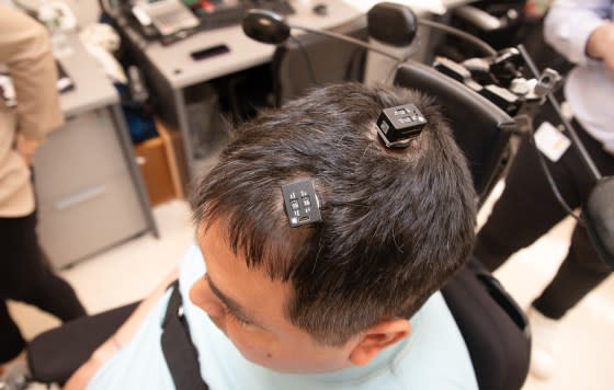 Keith Thomas, who lives with paralysis, had five tiny electrode arrays implanted in his brain in a novel technique known as double neural bypass. When connected to a computer, the chips use artificial intelligence to decode and translate his thoughts into action.<span class="copyright">Courtesy Feinstein Institutes for Medical Research</span>