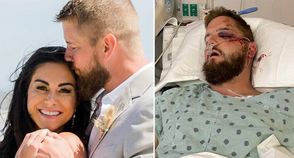 LEFT: Aric Hutchinson and his new wife Sam embrace in a wedding photo. RIGHT: Aric lies in a hospital bed with a black eye and blood on his face