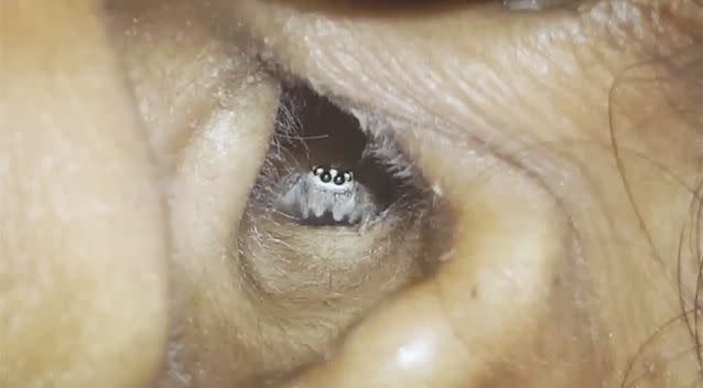 The doctor said it was a rare case to see a spider moving around inside the ear canal. Source: Newsflare