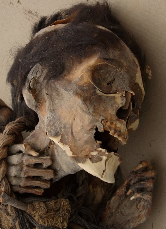 As expected, the team detected arsenic in the mummy's hair and in the soil. They also discovered skin conditions indicative of arsenic poisoning.