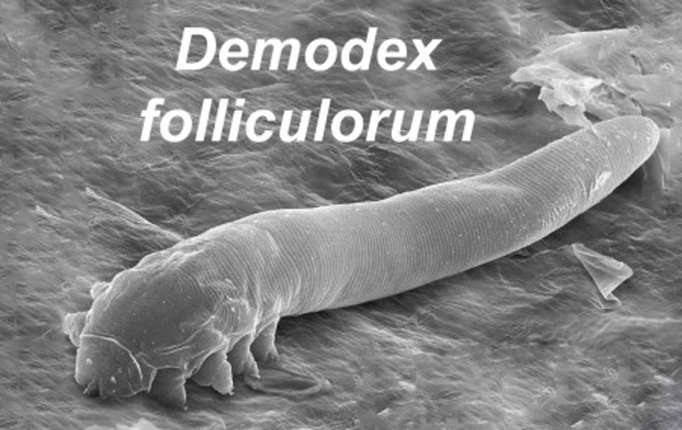 The microscopic mites are changing from external parasites to internal symbionts (Palopoli et al.; licensee BioMed Central. 2014/CC BY 4.0)