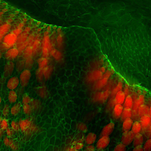 Motion detecting sensory cells of the inner ear. 