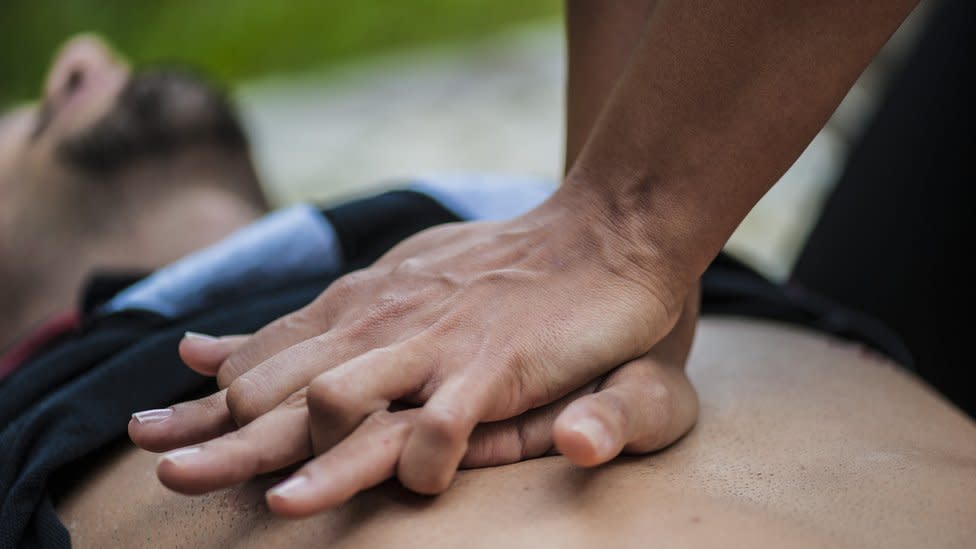 Un hombre recibe resucitación cardiopulmonar RCP