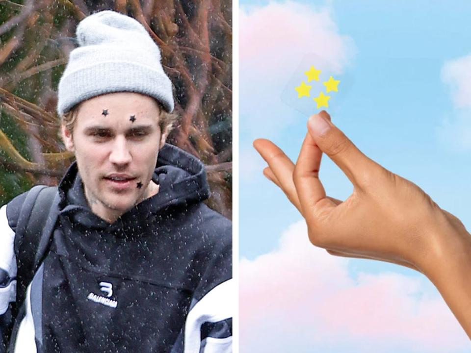 Justin Bieber wearing black Starface acne patches on left/ a hand holding up yellow star-shaped acne patches