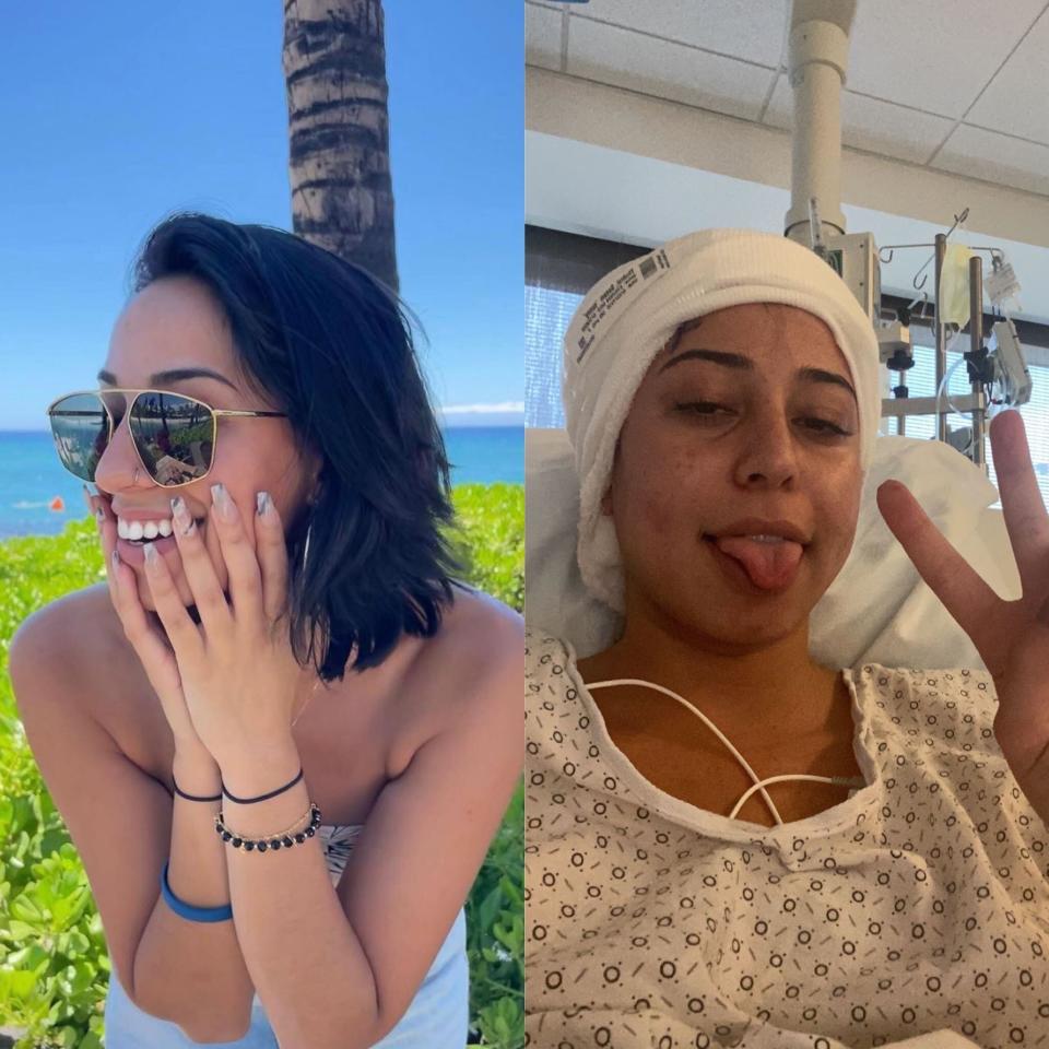 Sunny Thukral before and after diagnosis