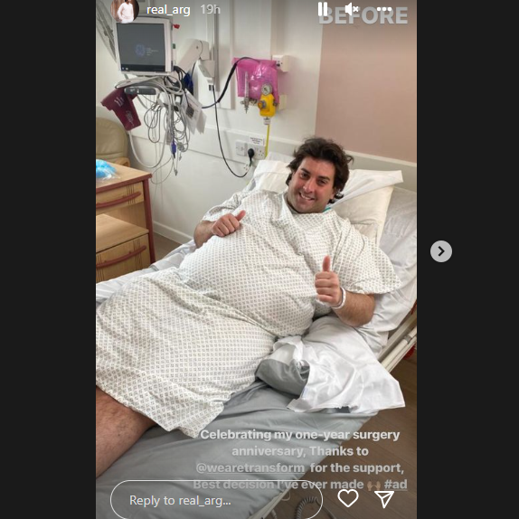 The star said the surgery was the best decision he'd ever made. (James Argent Instagram)