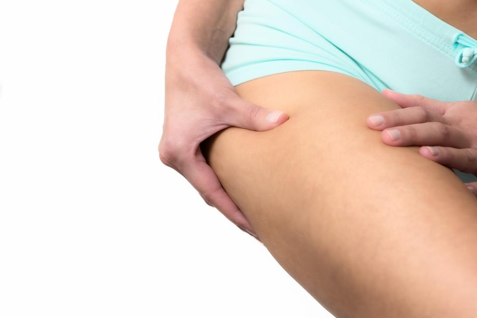 Cellulite ist nicht immer sichtbar und sollte Frauen nicht peinlich sein. (Bild: ddp)