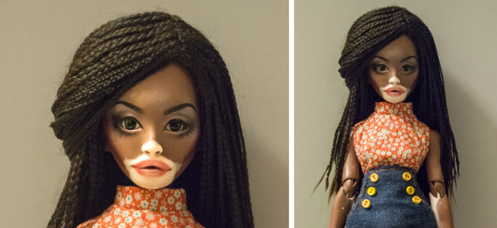 The inspiration for this doll was model Winnie Harlow, and it’s taking over social media. (Photo: winonaflammery.tumblr.com)