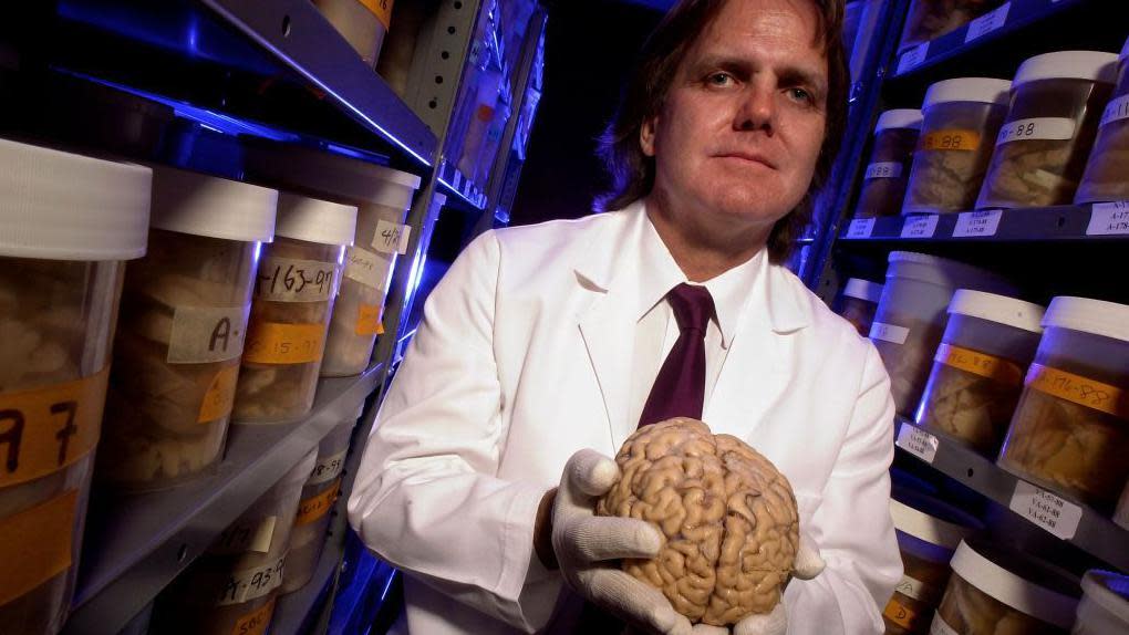 David Snowdon con un cerebro en las manos