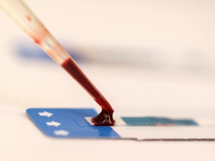 A nurse tests a blood sample during a free HIV test at a blood tests party REUTERS/Athit Perawongmetha 