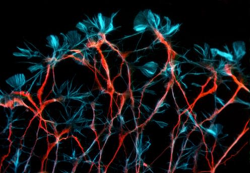 <span class="caption">Neurons in a rodent brain.</span> <span class="attribution"><a class="link " href="https://www.shutterstock.com/image-photo/neurons-rat-embryonic-dorsal-root-ganglion-1265983318?src=fqFfDiFPTLhbHUNt6xYOrQ-1-1" rel="nofollow noopener" target="_blank" data-ylk="slk:Heiti Paves/shutterstock;elm:context_link;itc:0;sec:content-canvas">Heiti Paves/shutterstock</a></span>