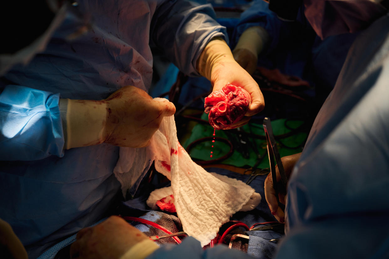 Surgeons prepare a genetically modified pig heart for xenotransplantation at NYU Langone Health on Wednesday, July 6, 2022, in New York. (Joe Carrotta for NYU Langone Health )