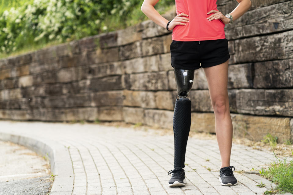 a woman with a prosthetic leg