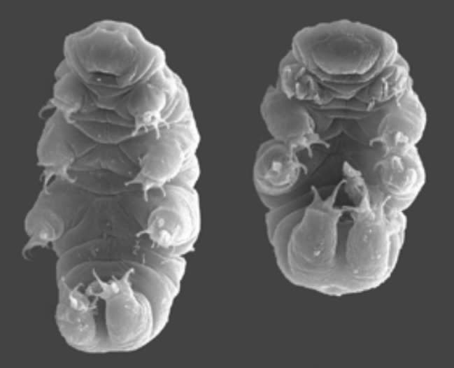 Tardigrades look like eight-legged maggots with puckered mouths. Source: Yahoo UK