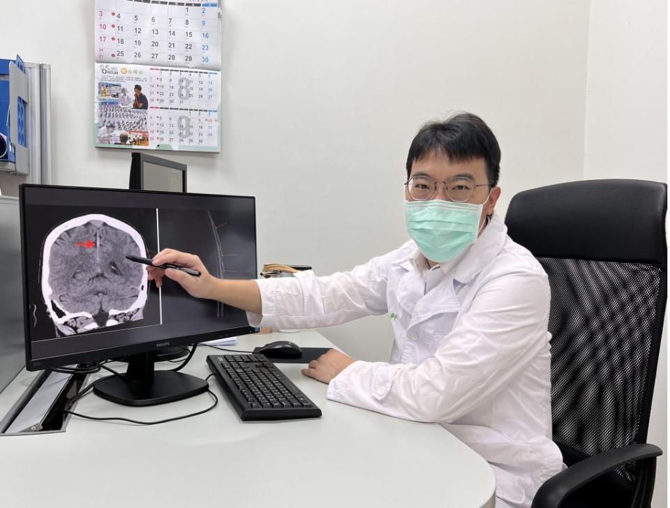 醫師李承軒說明低腦壓患者的影像檢查結果，發現有腦靜脈竇鼓漲及輕微硬腦膜下血腫等症狀。（記者彭新茹攝）