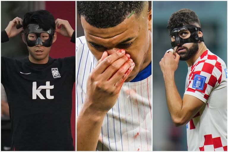 Kylian Mbappé, con fractura de nariz, intentará seguir jugando en la Euro 2024, pero deberá utilizar una máscara, como en su momento lo hicieron Son Heung-min y Josko Gvardiol, entre otros