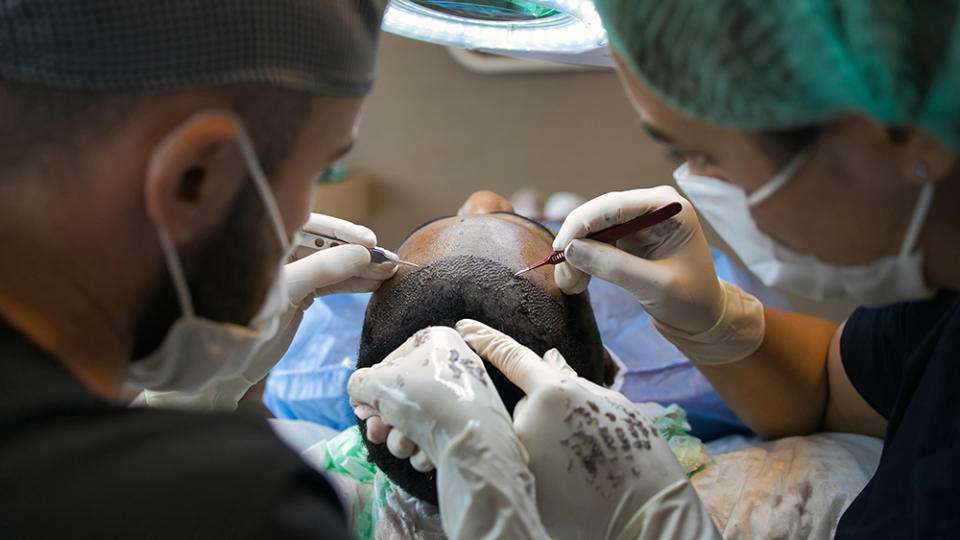 Hair Transplant