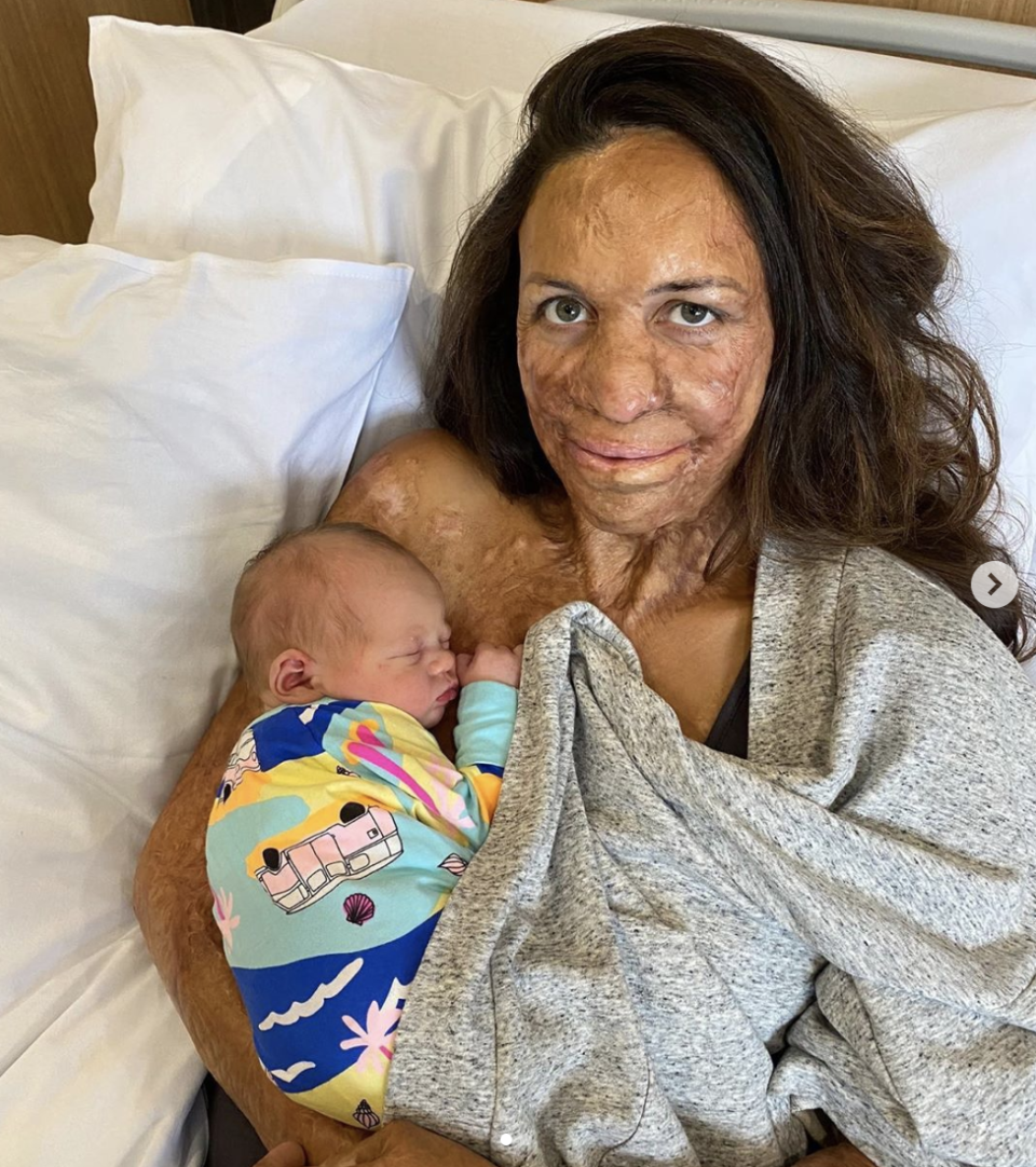 Turia Pitt and her second son