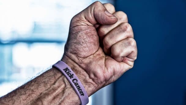 PHOTO: Stock photo of a fist with cancer bracelet.  (STOCK PHOTO/Getty Images)