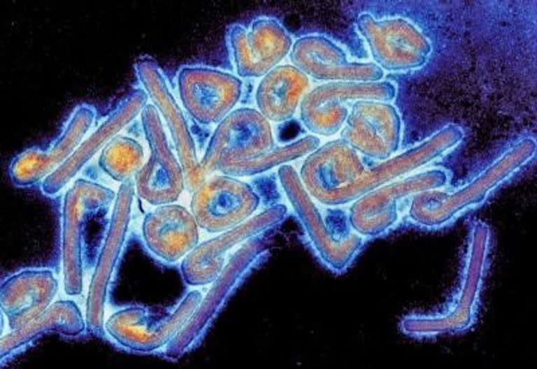Imagen del virus de Marburgo