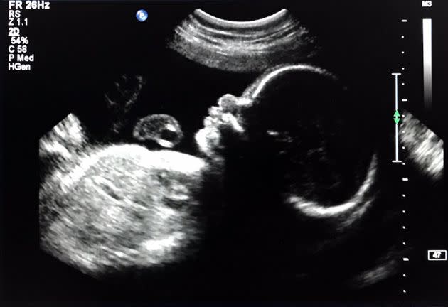An ultrasound of the writer's son.