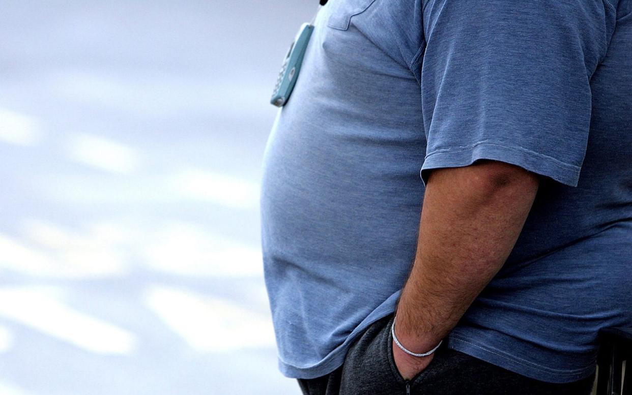 Patients with abdominal obesity had significantly higher X-ray scores, the study found - Paul Ellis/AFP