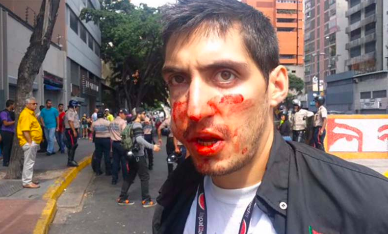 Los periodistas y fotógrafos del portal informativo venezolano La Patilla han sido objeto de ataques y robos. (Captura de pantalla Yahoo Noticias)