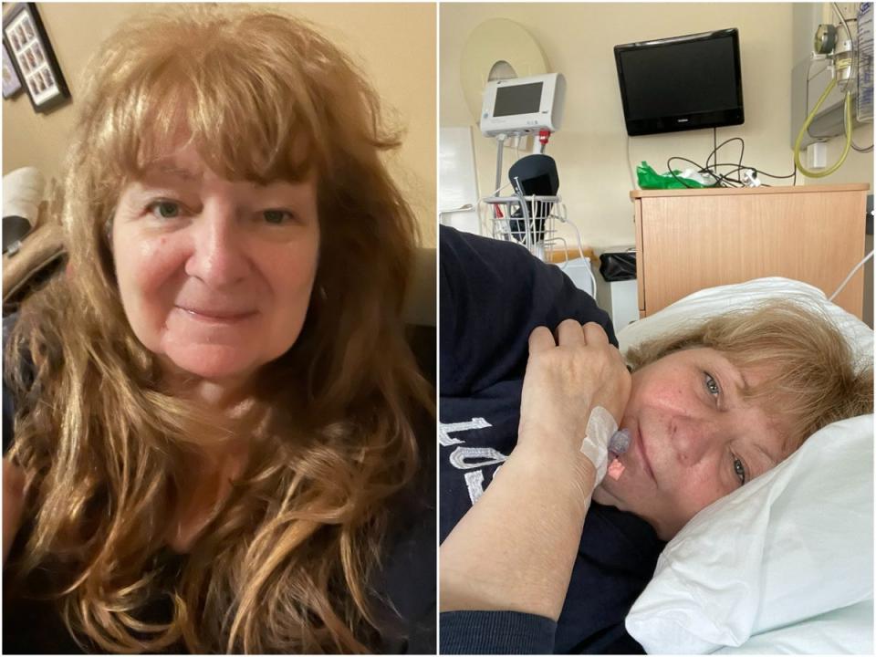 Godley the night before her operation (left) and at her initial diagnosis (Janey Godley/Twitter)