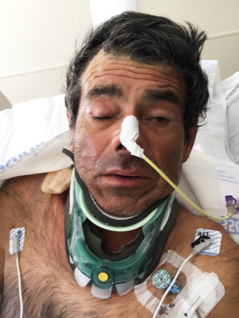 The North Sacramento California Highway Patrol and UC Davis Medical Center are asking for the public's help in identifying a patient. (Courtesy UC Davis Medical Center)