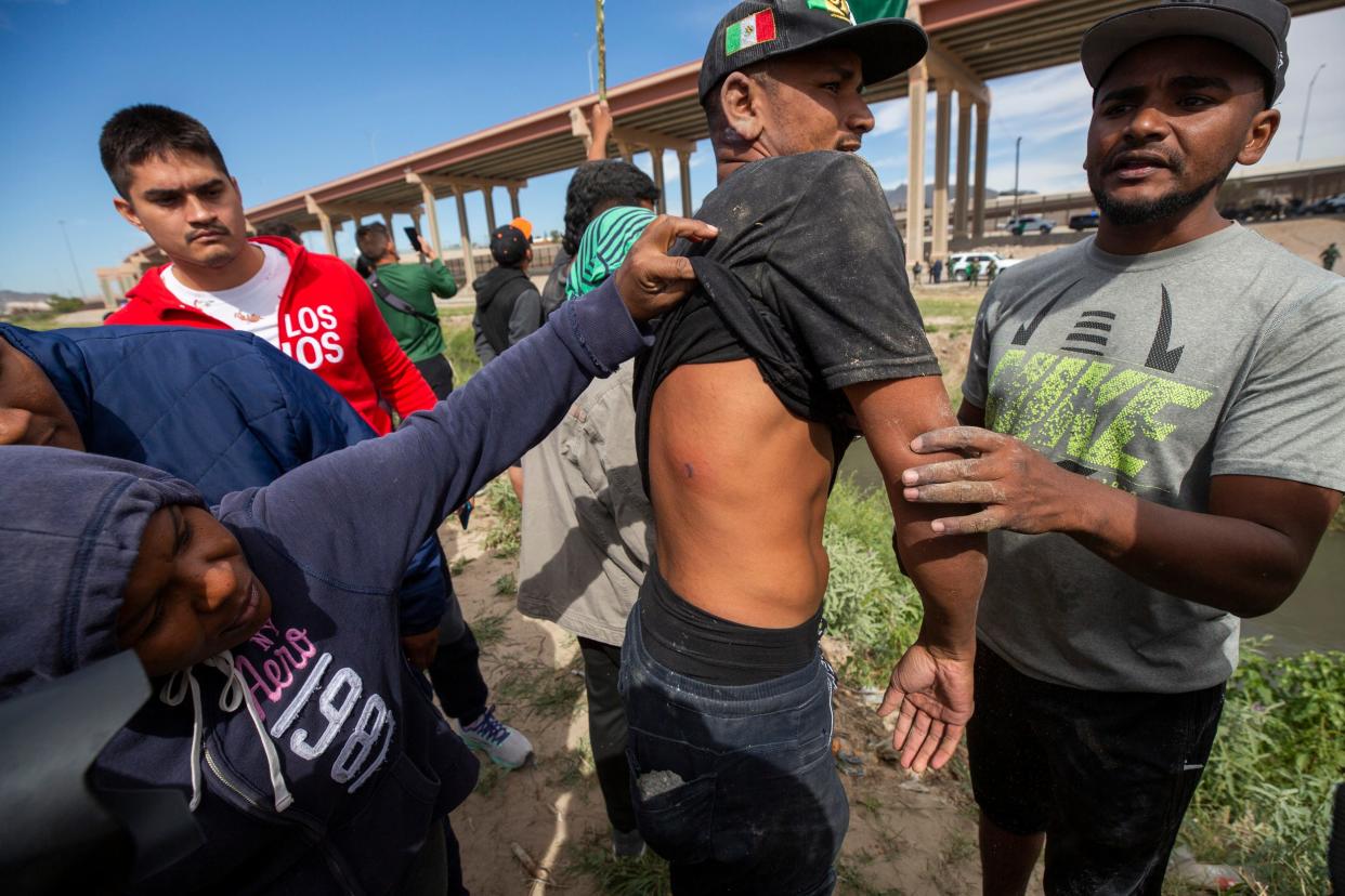 A migrant shows injuries sustained after being shot with a projectile by border agents after crossing the Rio Grande on Oct. 31, 2022.