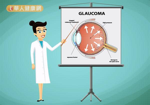 青光眼發生的原因主要是因為眼壓長期處於過高狀態下，進而壓迫視神經引起。