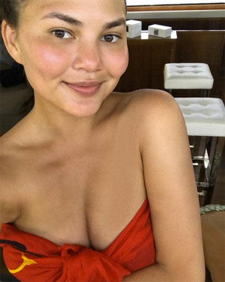 Chrissy Teigen