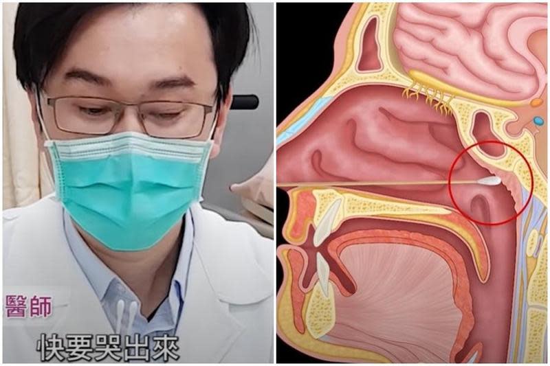 蘇一峰醫師用3分鐘影片示範如何居家快篩。（翻攝自蘇一峰臉書）